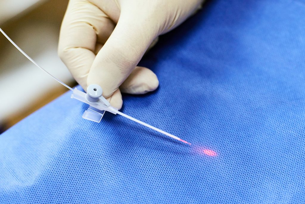 Laserowe leczenie żylaków – jak wygląda?