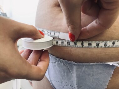 Liposukcja ultradźwiękowa – na czym polega i jakie efekty można uzyskać?