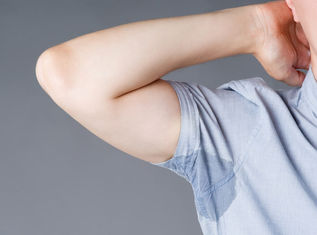 Nadpotliwość pach – jaką metodę leczenia wybrać?