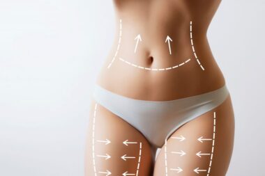 Liposukcja – przegląd metod odsysania tłuszczu