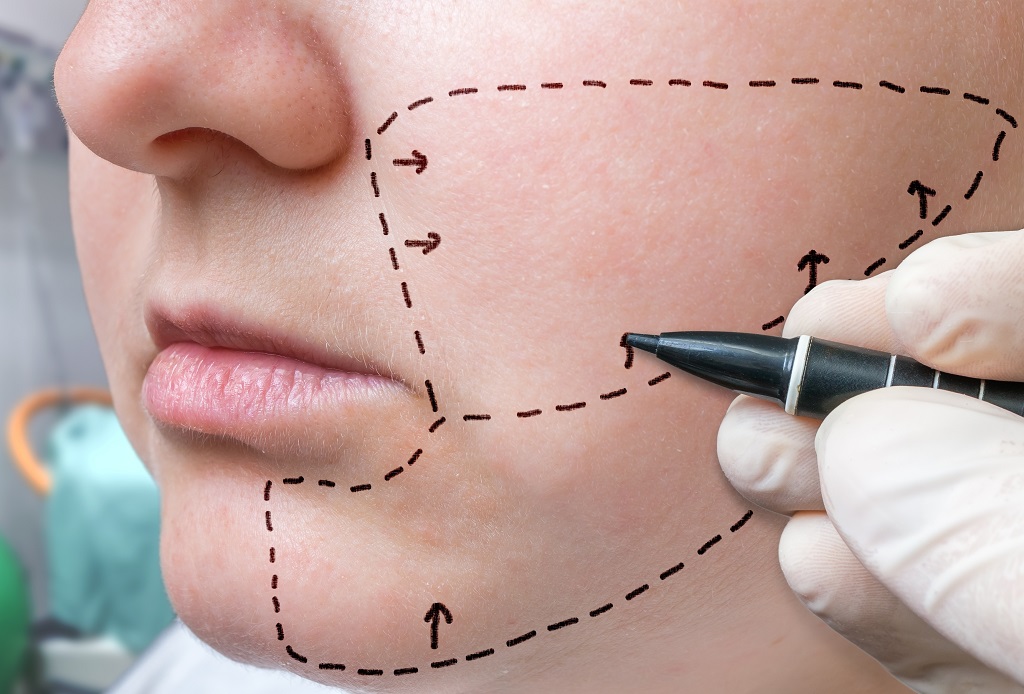 Bezpłatne zabiegi buccal fat removal w ramach szkoleń lekarskich