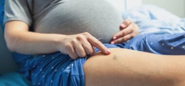 Żylaki w ciąży – co robić, jeżeli się pojawią?