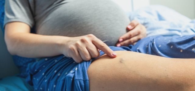 Żylaki w ciąży – co robić, jeżeli się pojawią?