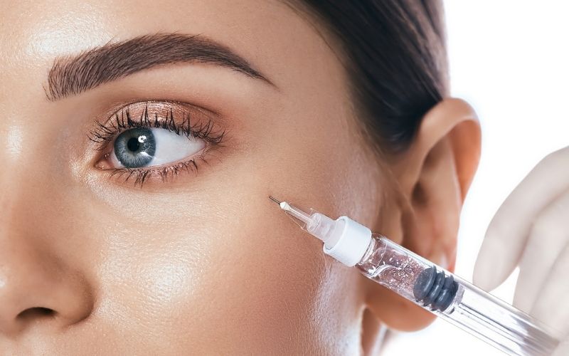 Mezoterapia igłowa pod oczy – najczęstsze pytania