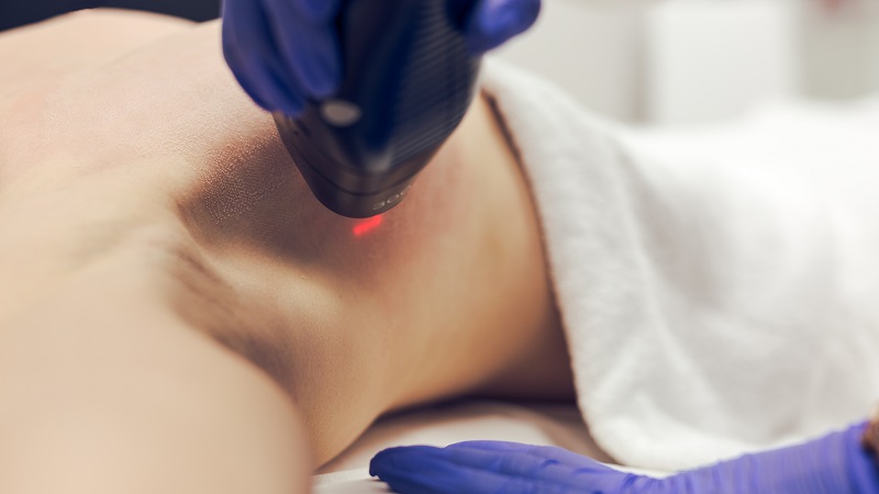 laser ablacyjny na piersi