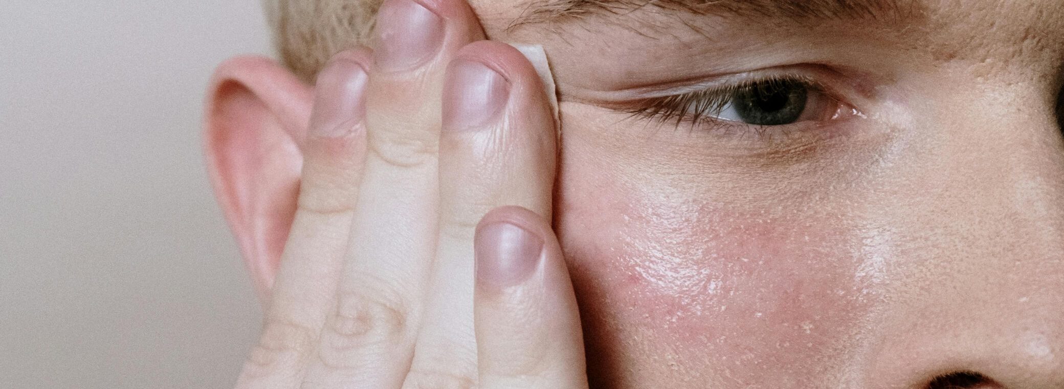 Choroby skóry (dermatozy) – jakie występują najczęściej? Jak je rozpoznać i leczyć?